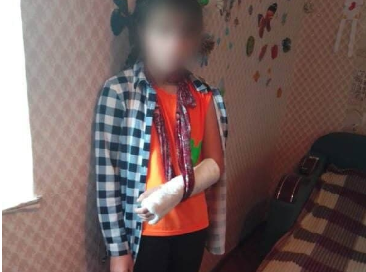 травма урок физкультуры