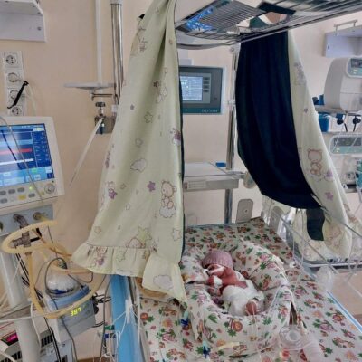 операція на серці у дитини