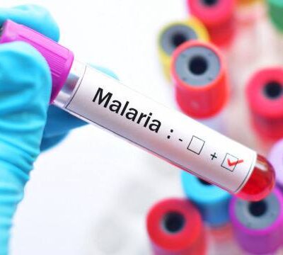 Одещина ммалярія