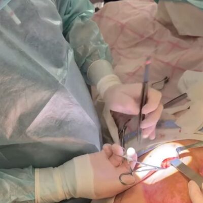 Одеска обласна лікарня унікальна операція військовослужбовцю