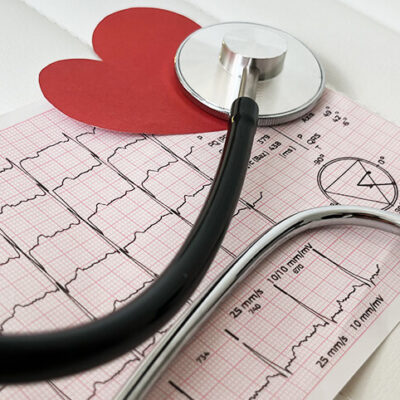 Ізмаїл прийом кардіохірурга